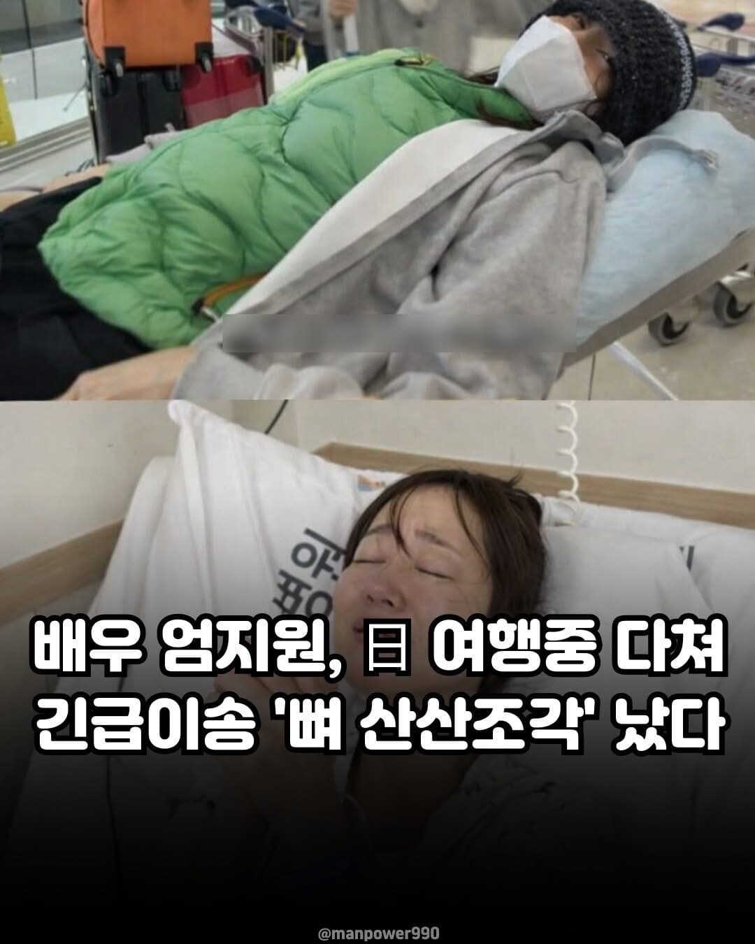 배우 엄지원 일본여행중 뼈 산산조작 남