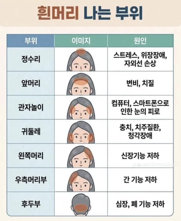 흰머리 나는 이유